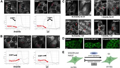 The enigma of ultraviolet radiation stress granules: Research challenges and new perspectives